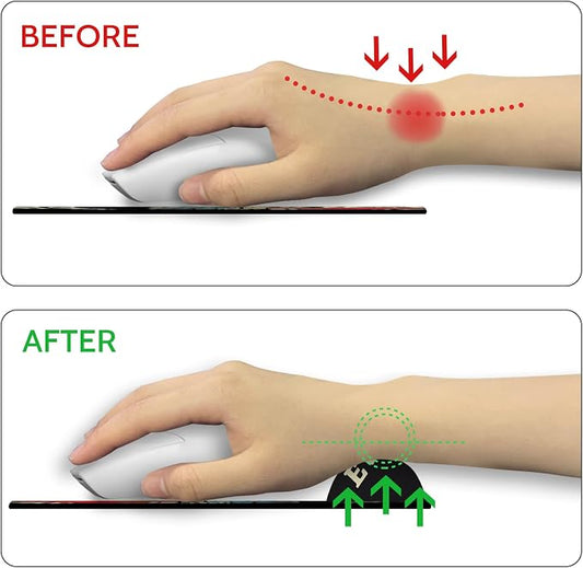 Ergonomic Mouse Pad with Wrist Support, Gothic Skull Skeleton Mouse Pad with Wrist Rest, Gaming Mousepad with Non-Slip Pain Relief PU Base, Cute Mouse Pad for Desk Accessories Office Supplies Decor