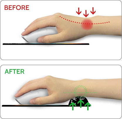 Ergonomic Mouse Pad with Wrist Rest Dumpster on Fire Gaming Mousepad Funny | Wrist Support Pain Relief, Cute, Office Desk Accessories, Work, Home, Non-Slip PU Base, for Wireless Mouse Computer Laptop